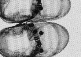 Space Landing hinderschlatterfeuz-karte 